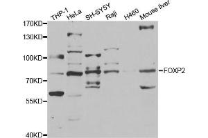Western blot analysis of extracts of various cell lines, using FOXP2 antibody (ABIN5973317) at 1/1000 dilution. (FOXP2 Antikörper)