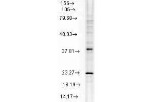 Hsp22 Western Blot. (HSPB8 Antikörper)