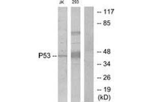 Western Blotting (WB) image for anti-Tumor Protein P53 (TP53) (AA 1-50) antibody (ABIN2889047) (p53 Antikörper  (AA 1-50))