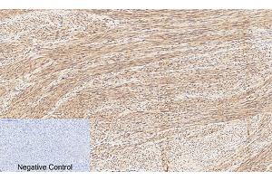 Immunohistochemical analysis of paraffin-embedded human uterus tissue. (CREB1 Antikörper  (pSer133))