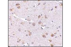 Immunohistochemistry of SATB1 in human brain with this product at 5 μg/ml. (SATB1 Antikörper  (C-Term))
