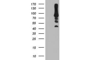 HEK293T cells were transfected with the pCMV6-ENTRY control (Left lane) or pCMV6-ENTRY PFKP (Right lane) cDNA for 48 hrs and lysed. (PFKP Antikörper)