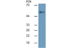 Western Blotting (WB) image for Matrix Metallopeptidase 3 (Stromelysin 1, Progelatinase) (MMP3) ELISA Kit (ABIN6730865)