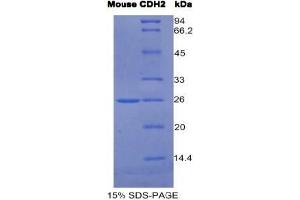 SDS-PAGE analysis of Mouse Cadherin, Neuronal Protein. (N-Cadherin Protein)