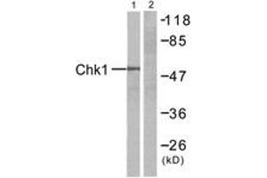 Western blot analysis of extracts from HT-29 cells, treated with UV, using Chk1 (Ab-345) Antibody. (CHEK1 Antikörper  (AA 310-359))