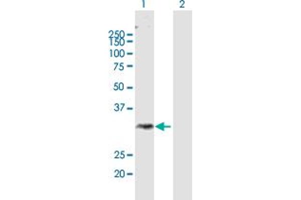 AWAT1 Antikörper  (AA 1-328)