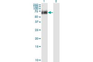 Western Blotting (WB) image for anti-Receptor-Interacting Serine-threonine Kinase 2 (RIPK2) (AA 431-540) antibody (ABIN522206)