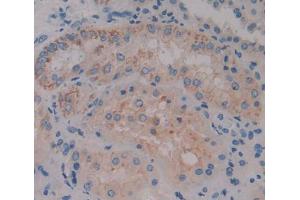 IHC-P analysis of kidney tissue, with DAB staining. (ACOX1 Antikörper  (AA 210-409))