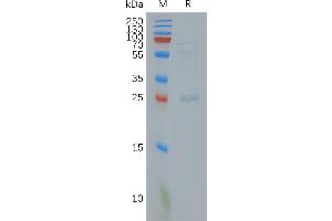 Human C. (CLDN18.2 Protein)