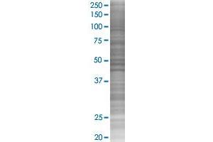 Western Blotting (WB) image for TRPA1 293T Cell Transient Overexpression Lysate(Denatured) (ABIN1334350)