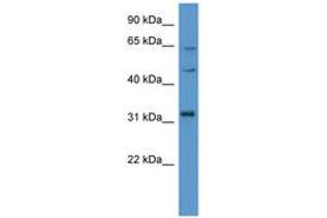 Image no. 1 for anti-MAP Kinase Interacting serine/threonine Kinase 1 (MKNK1) (C-Term) antibody (ABIN6746809) (MKNK1 Antikörper  (C-Term))