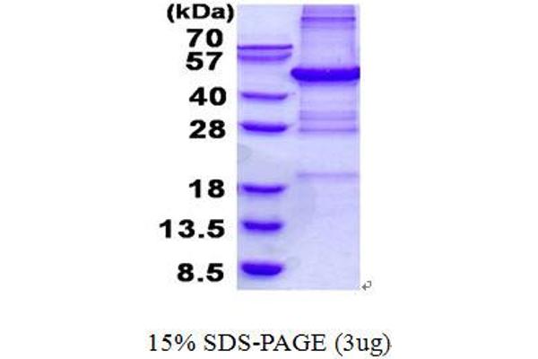 PHF11 Protein (His tag)