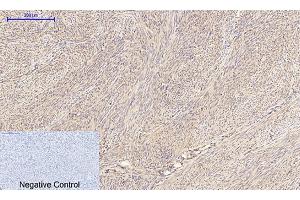 Immunohistochemical analysis of paraffin-embedded human uterus tissue. (IRS1 Antikörper)