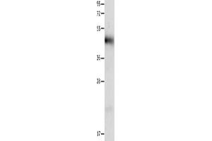 Gel: 12 % SDS-PAGE, Lysate: 40 μg, Lane: Human liver cancer tissue, Primary antibody: ABIN7191316(LRP1 Antibody) at dilution 1/1250, Secondary antibody: Goat anti rabbit IgG at 1/8000 dilution, Exposure time: 40 seconds (LRP1 Antikörper)