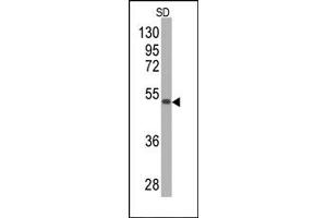 Western Blotting (WB) image for anti-Superoxide Dismutase 2, Mitochondrial (SOD2) antibody (ABIN356396) (SOD2 Antikörper)