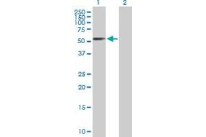 Western Blot analysis of RARB expression in transfected 293T cell line by RARB MaxPab polyclonal antibody. (Retinoic Acid Receptor beta Antikörper  (AA 1-448))