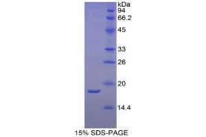 SDS-PAGE analysis of Rat RBP2 Protein. (RBP2 Protein)