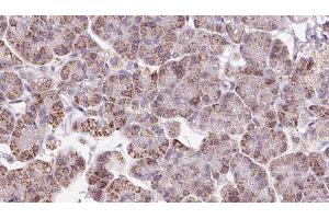 ABIN6273237 at 1/100 staining Human pancreas cancer tissue by IHC-P. (EIF3I Antikörper  (C-Term))