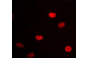 Immunofluorescent analysis of hnRNP D0 staining in HEK293 cells. (HNRNPD/AUF1 Antikörper  (Center))