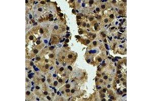 Immunohistochemical analysis of CALCOCO1 staining in human kidney formalin fixed paraffin embedded tissue section. (CALCOCO1 Antikörper)