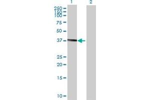 Lane 1: B4GALNT1 transfected lysate ( 36. (B4GALNT1 293T Cell Transient Overexpression Lysate(Denatured))