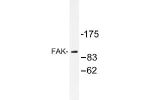 Image no. 1 for anti-PTK2 Protein tyrosine Kinase 2 (PTK2) antibody (ABIN272100) (FAK Antikörper)