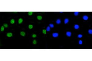 A549 cells were stained with Rb(S807) (2D10) Monoclonal Antibody  at [1:200] incubated for overnight at 4C, followed by secondary antibody incubation and DAPI staining. (Retinoblastoma 1 Antikörper  (pSer807))