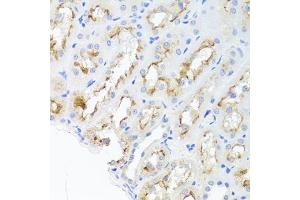 Immunohistochemistry of paraffin-embedded rat kidney using ADIPOQ Antibody (ABIN5971370) at dilution of 1/100 (40x lens). (ADIPOQ Antikörper)
