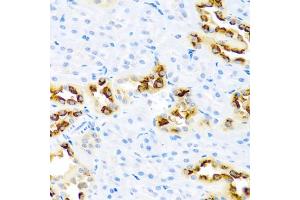 Immunohistochemistry of paraffin-embedded rat kidney using KLK11 antibody. (Kallikrein 11 Antikörper)