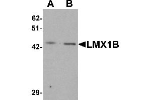 Western Blotting (WB) image for anti-LIM Homeobox Transcription Factor 1, beta (LMX1B) (C-Term) antibody (ABIN1077396) (LMX1B Antikörper  (C-Term))