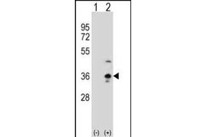Western blot analysis of COLEC11 (arrow) using rabbit polyclonal COLEC11 Antibody (N-term) (ABIN390822 and ABIN2841053). (COLEC11 Antikörper  (N-Term))