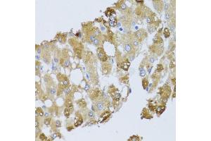 Immunohistochemistry of paraffin-embedded human liver injury using BNIP3 antibody (ABIN5973321) at dilution of 1/100 (40x lens). (BNIP3 Antikörper)