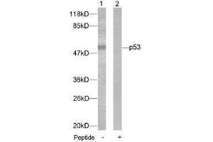 Image no. 1 for anti-Tumor Protein P53 (TP53) (Ser46) antibody (ABIN197252) (p53 Antikörper  (Ser46))