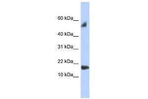 FLJ35767 antibody used at 1 ug/ml to detect target protein. (FLJ35767 (Middle Region) Antikörper)