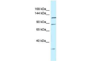 Western Blot showing Tmem132d antibody used at a concentration of 1. (TMEM132D Antikörper  (Middle Region))