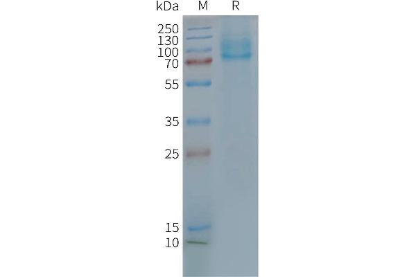 GLP2R Protein