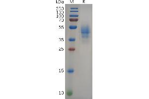 Human NEFL(9-88) Protein, hFc Tag on SDS-PAGE under reducing condition. (NEFL Protein (AA 9-88) (Fc Tag))