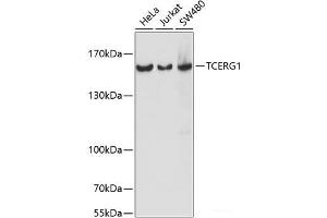 Western blot analysis of extracts of various cell lines using TCERG1 Polyclonal Antibody at dilution of 1:1000. (TCERG1 Antikörper)