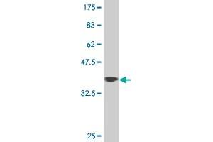 Western Blot detection against Immunogen (37. (ZNF281 Antikörper  (AA 787-893))