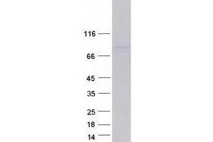 Validation with Western Blot (DDX17 Protein (Transcript Variant 1) (Myc-DYKDDDDK Tag))