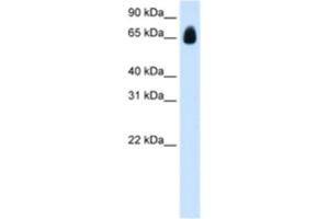 Western Blotting (WB) image for anti-Tripartite Motif Containing 32 (TRIM32) antibody (ABIN2461828) (TRIM32 Antikörper)