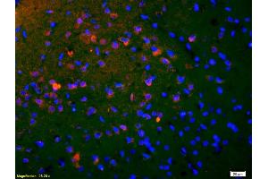 Immunofluorescence (IF) image for anti-cAMP Responsive Element Binding Protein 1 (CREB1) (pSer133) antibody (ABIN723980)