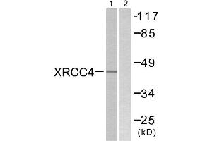 Western blot analysis of extracts from COLO205 cells, using XRCC4 antibody. (XRCC4 Antikörper  (C-Term))