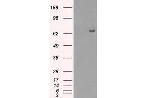 HEK293T cells were transfected with the pCMV6-ENTRY control (Left lane) or pCMV6-ENTRY HDAC10 (Right lane) cDNA for 48 hrs and lysed. (HDAC10 Antikörper)