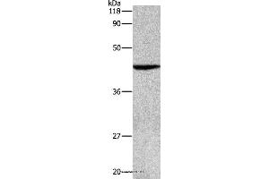 Western blot analysis of Hela cell, using APG4B Polyclonal Antibody at dilution of 1:500 (ATG4B Antikörper)