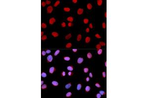 Immunofluorescence (IF) image for anti-Minichromosome Maintenance Complex Component 6 (MCM6) (AA 562-821) antibody (ABIN6219105) (MCM6 Antikörper  (AA 562-821))