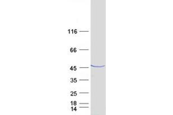 RALYL Protein (Transcript Variant 3) (Myc-DYKDDDDK Tag)