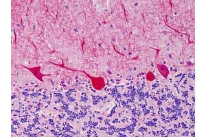 Human Cerebellum: Formalin-Fixed, Paraffin-Embedded (FFPE) (CARD11 Antikörper)