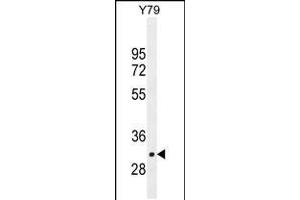 Western blot analysis in Y79 cell line lysates (35ug/lane). (LRRC46 Antikörper  (N-Term))