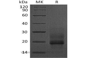 Western Blotting (WB) image for CD4 (CD4) (Active) protein (His tag) (ABIN7317131) (CD4 Protein (CD4) (His tag))